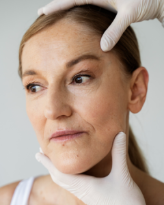 Flacidez facial após Mounjaro? Entenda o que acontece e como tratar